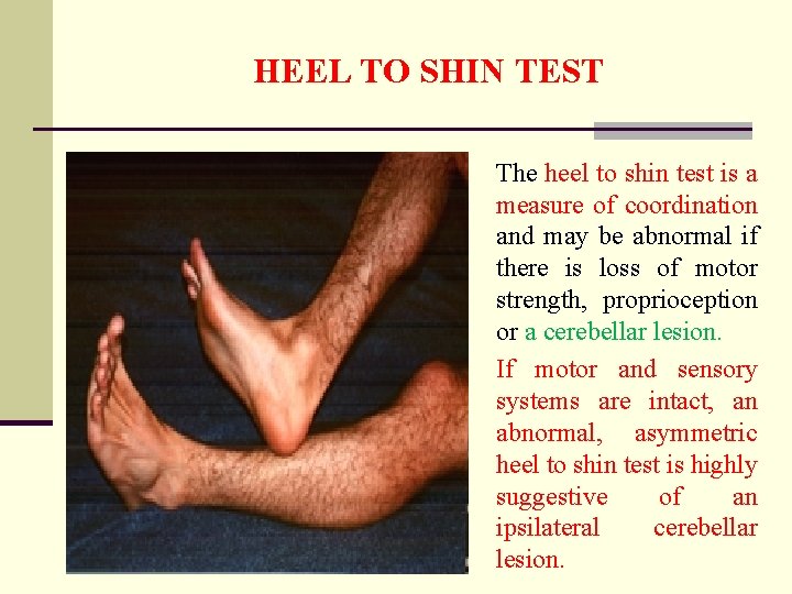 HEEL TO SHIN TEST The heel to shin test is a measure of coordination