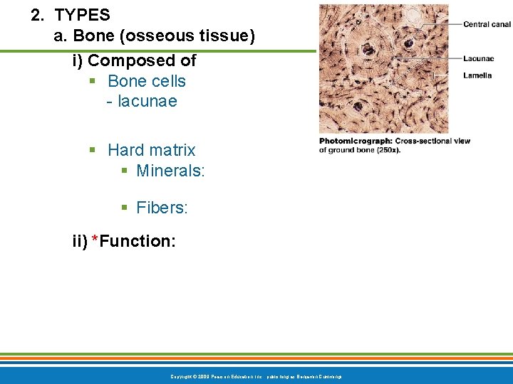 2. TYPES a. Bone (osseous tissue) i) Composed of § Bone cells - lacunae