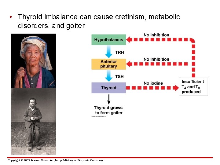  • Thyroid imbalance can cause cretinism, metabolic disorders, and goiter Copyright © 2003