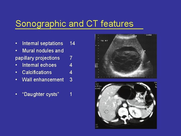 Sonographic and CT features • Internal septations • Mural nodules and papillary projections •