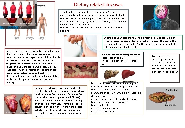 Dietary related diseases Type 2 diabetes occurs when the body doesn't produce enough insulin