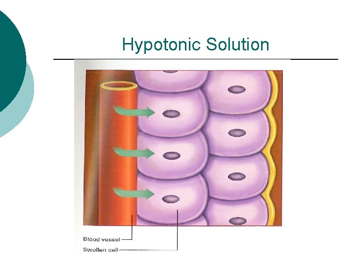 Hypotonic Solution 