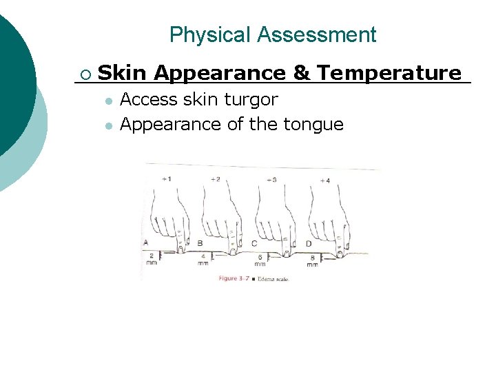 Physical Assessment ¡ Skin Appearance & Temperature l l Access skin turgor Appearance of
