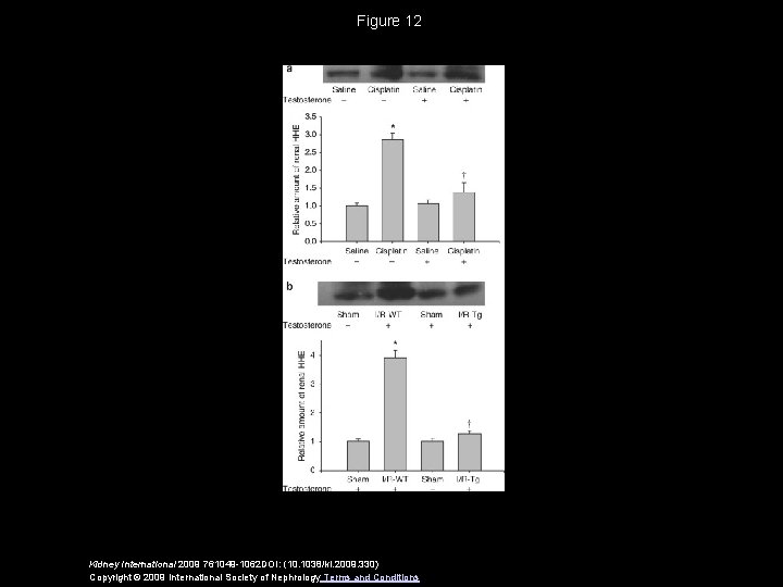 Figure 12 Kidney International 2009 761049 -1062 DOI: (10. 1038/ki. 2009. 330) Copyright ©