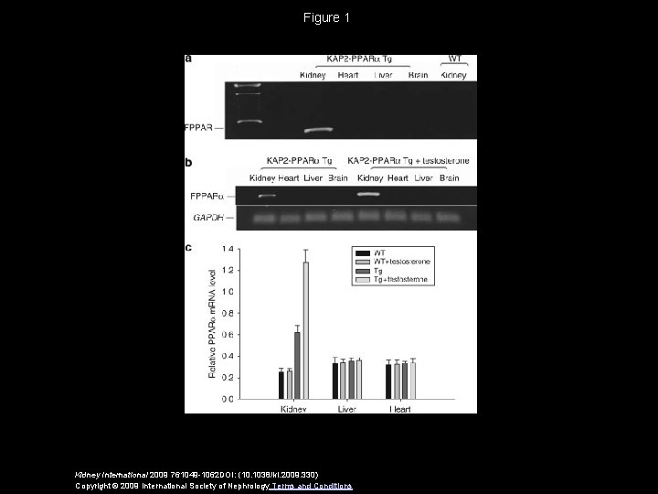 Figure 1 Kidney International 2009 761049 -1062 DOI: (10. 1038/ki. 2009. 330) Copyright ©