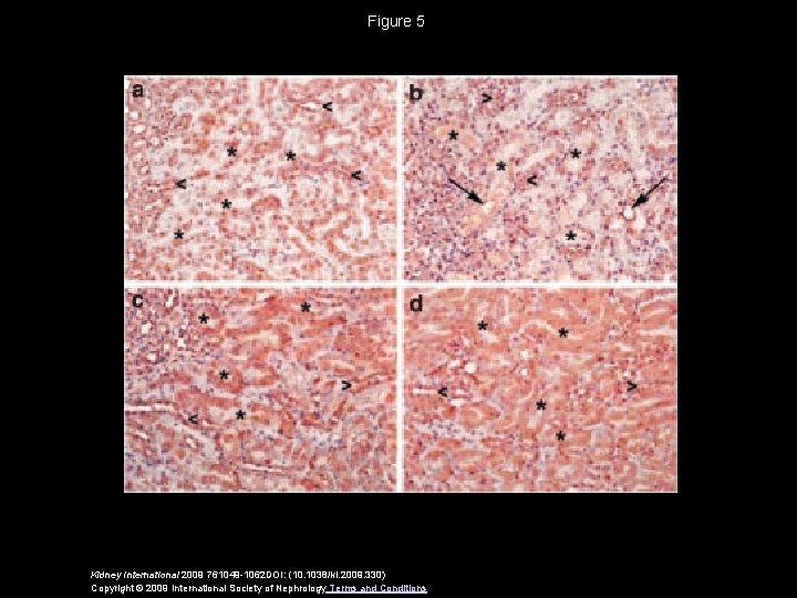 Figure 5 Kidney International 2009 761049 -1062 DOI: (10. 1038/ki. 2009. 330) Copyright ©