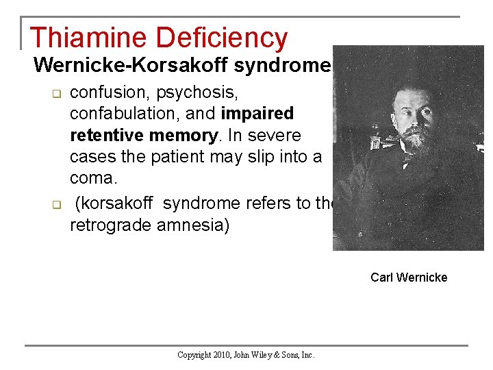 Thiamine Deficiency Wernicke-Korsakoff syndrome q q confusion, psychosis, confabulation, and impaired retentive memory. In