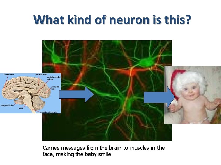 What kind of neuron is this? Carries messages from the brain to muscles in