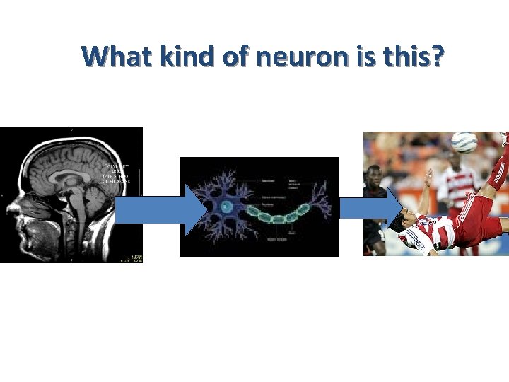What kind of neuron is this? 