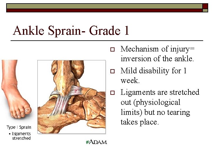 Ankle Sprain- Grade 1 o o o Mechanism of injury= inversion of the ankle.