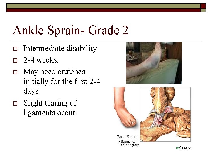 Ankle Sprain- Grade 2 o o Intermediate disability 2 -4 weeks. May need crutches