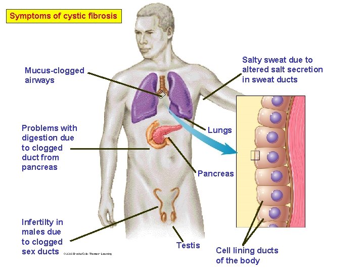 Symptoms of cystic fibrosis Salty sweat due to altered salt secretion in sweat ducts
