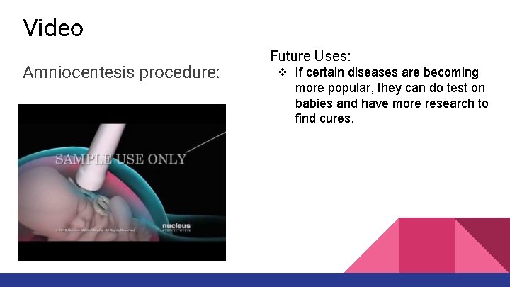 Video Amniocentesis procedure: Future Uses: ❖ If certain diseases are becoming more popular, they