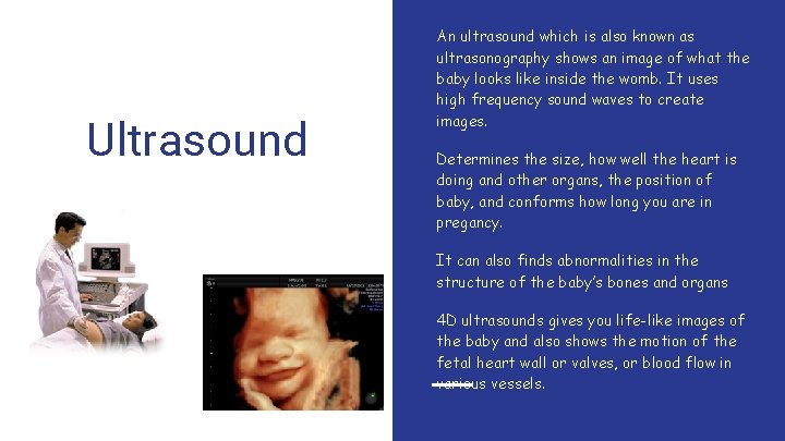 Ultrasound An ultrasound which is also known as ultrasonography shows an image of what