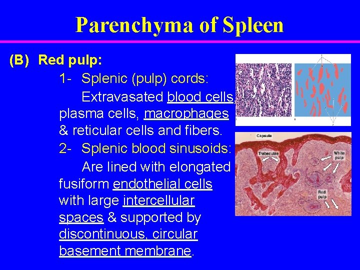 Parenchyma of Spleen (B) Red pulp: 1 - Splenic (pulp) cords: Extravasated blood cells,
