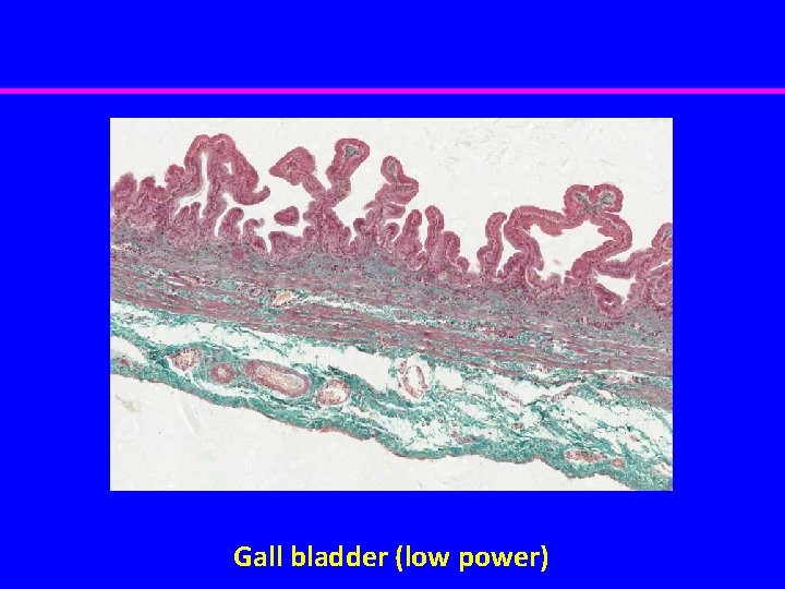 Gall bladder (low power) 