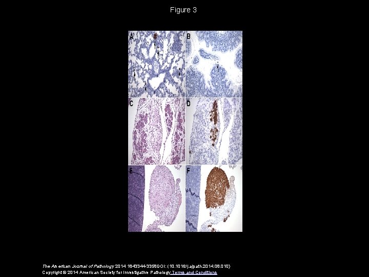 Figure 3 The American Journal of Pathology 2014 1843344 -3358 DOI: (10. 1016/j. ajpath.