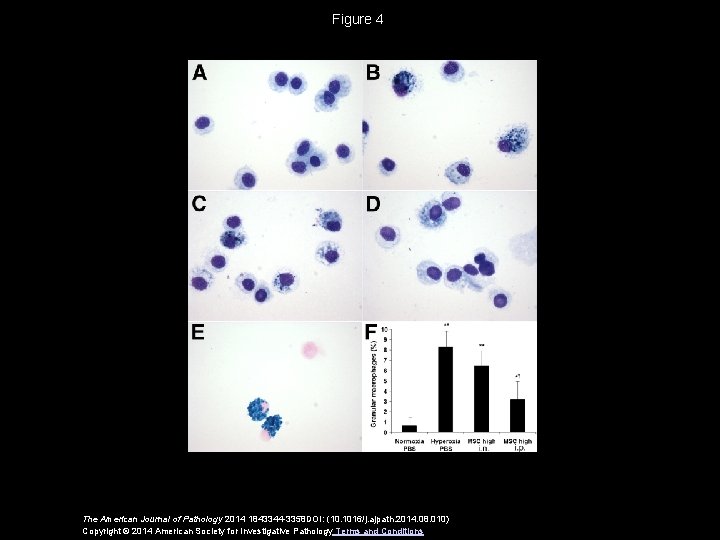 Figure 4 The American Journal of Pathology 2014 1843344 -3358 DOI: (10. 1016/j. ajpath.