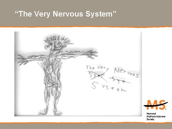 “The Very Nervous System” 