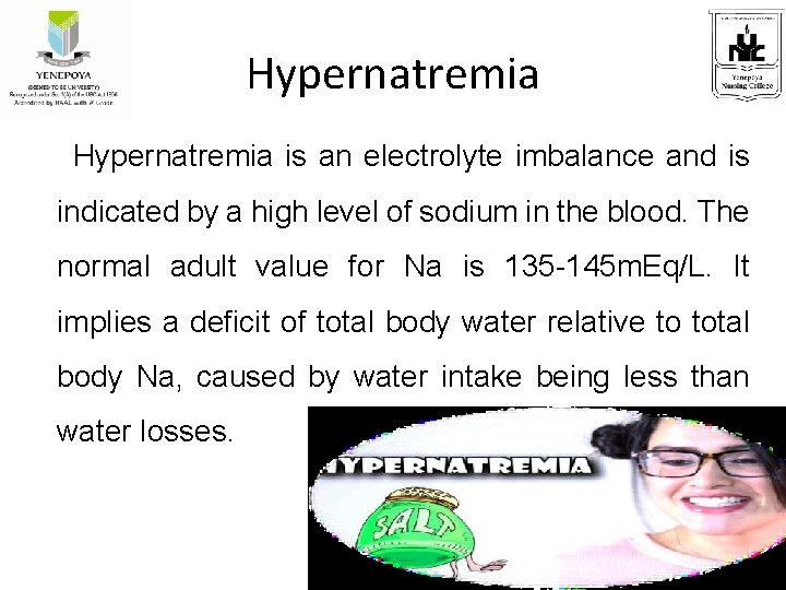 Hypernatremia is an electrolyte imbalance and is indicated by a high level of sodium