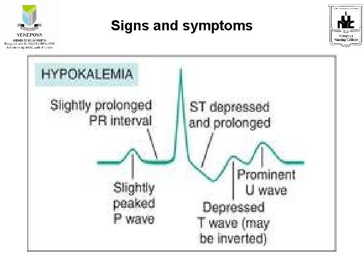 Signs and symptoms 