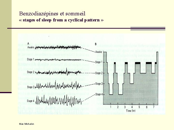 Benzodiazépines et sommeil « stages of sleep from a cyclical pattern » Max Michalon