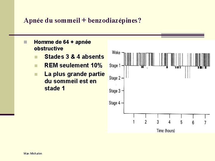 Apnée du sommeil + benzodiazépines? n Homme de 64 + apnée obstructive n n