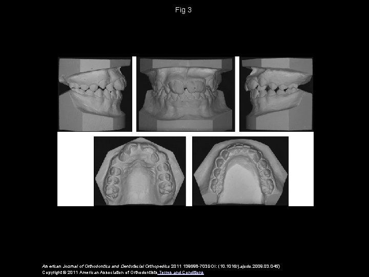 Fig 3 American Journal of Orthodontics and Dentofacial Orthopedics 2011 139698 -703 DOI: (10.