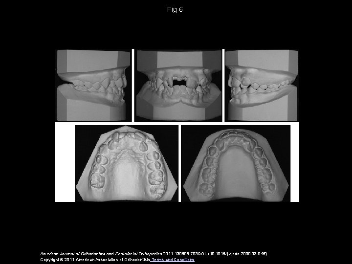 Fig 6 American Journal of Orthodontics and Dentofacial Orthopedics 2011 139698 -703 DOI: (10.