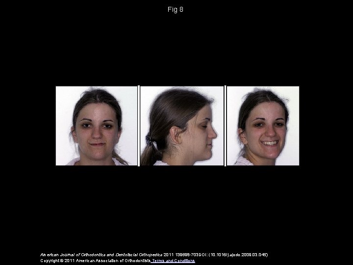 Fig 8 American Journal of Orthodontics and Dentofacial Orthopedics 2011 139698 -703 DOI: (10.