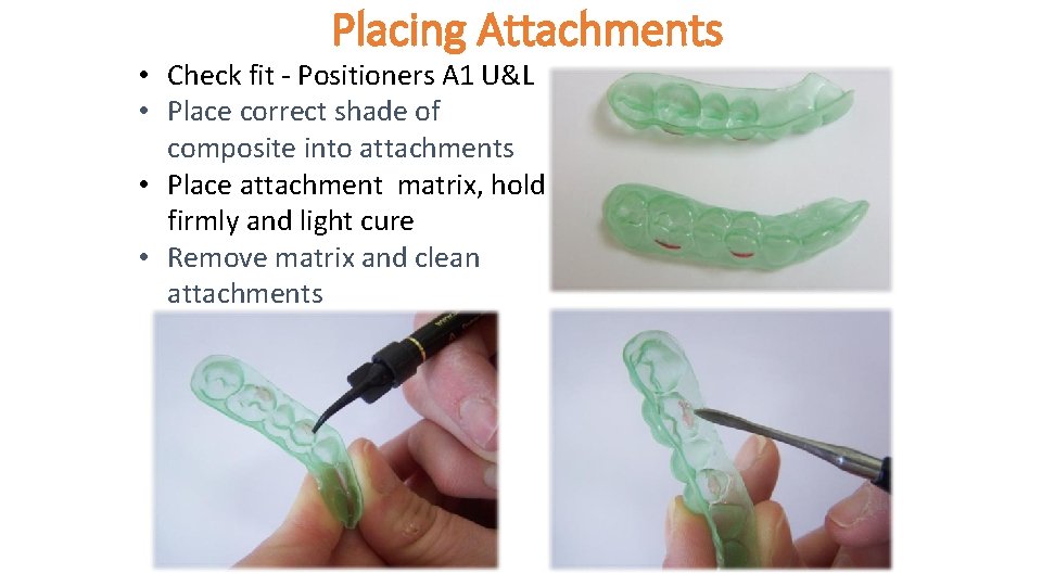 Placing Attachments • Check fit - Positioners A 1 U&L • Place correct shade