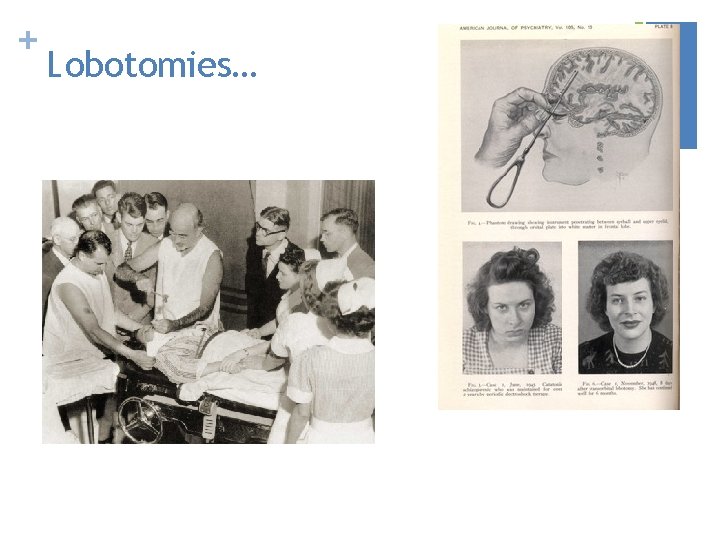 + Lobotomies… 