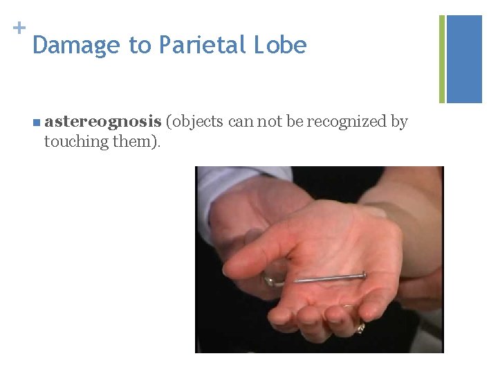 + Damage to Parietal Lobe n astereognosis (objects can not be recognized by touching