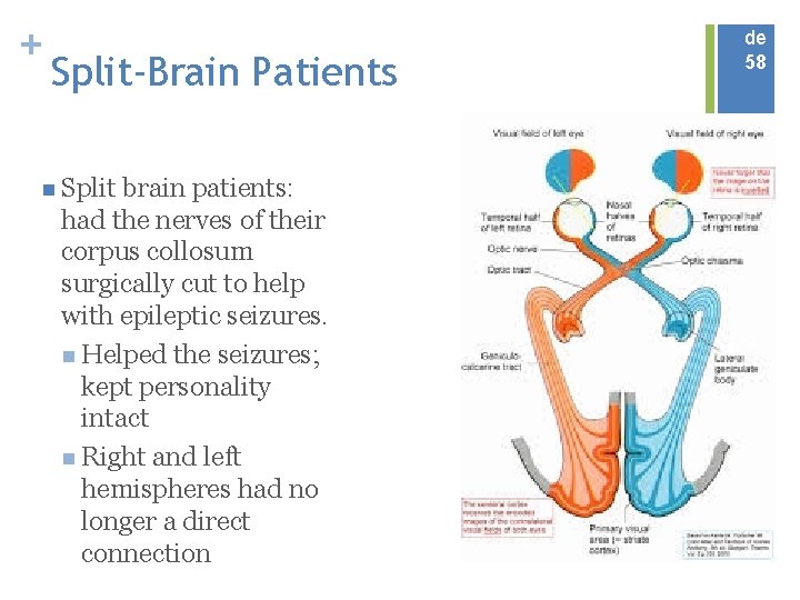 + Split-Brain Patients n Split brain patients: had the nerves of their corpus collosum