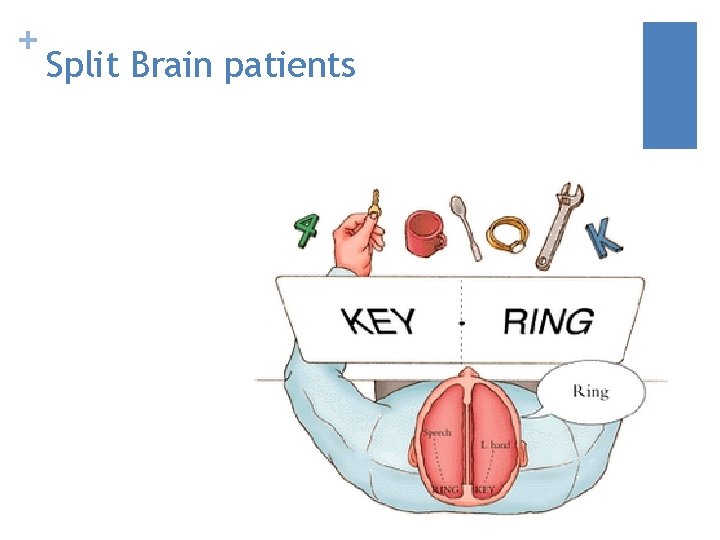 + Split Brain patients 