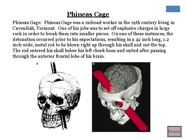 Phineas Cage Phineas Gage: Phineas Gage was a railroad worker in the 19 th