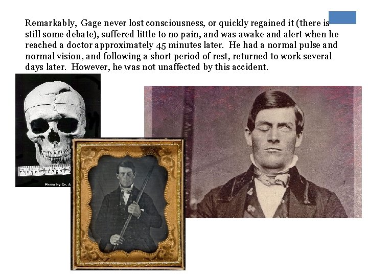 Remarkably, Gage never lost consciousness, or quickly regained it (there is still some debate),
