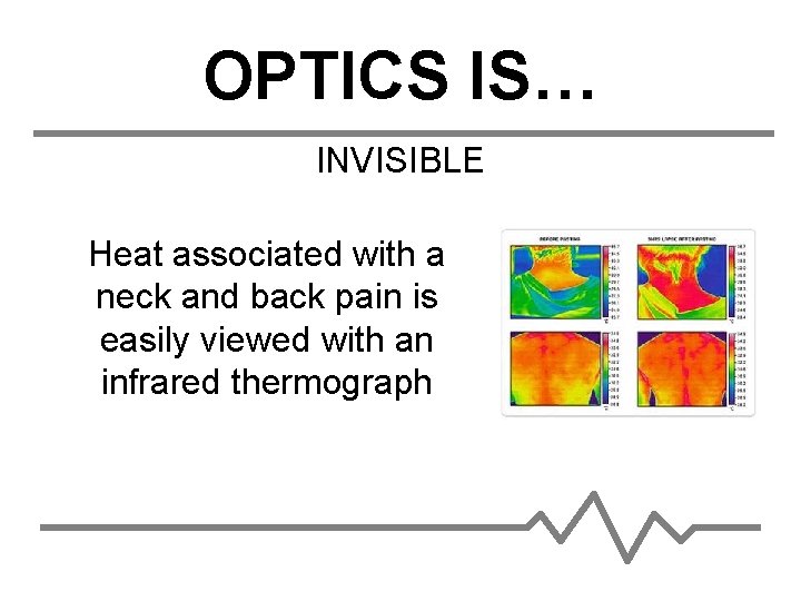 OPTICS IS… INVISIBLE Heat associated with a neck and back pain is easily viewed