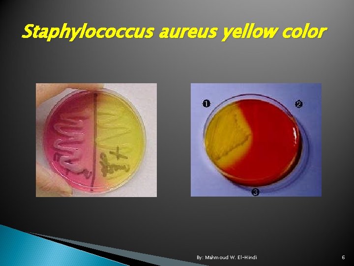 Staphylococcus aureus yellow color By: Mahmoud W. El-Hindi 6 