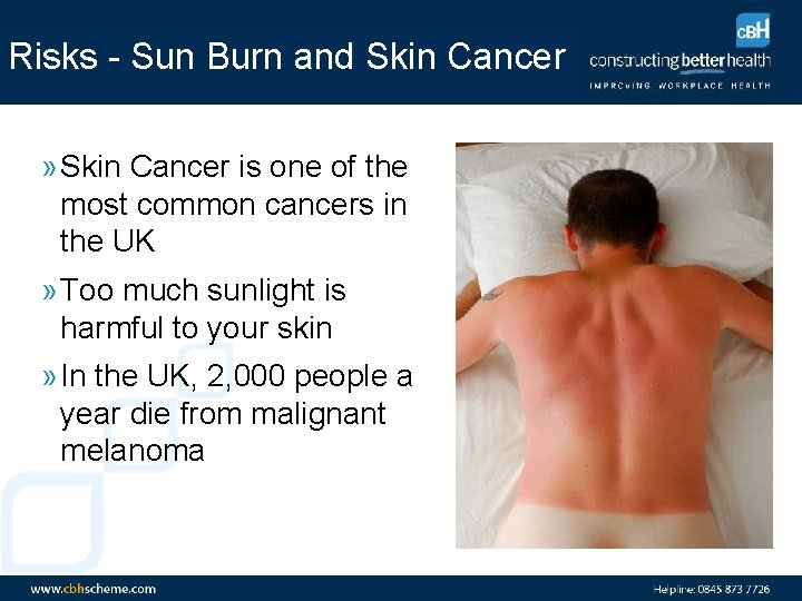 Risks - Sun Burn and Skin Cancer » Skin Cancer is one of the