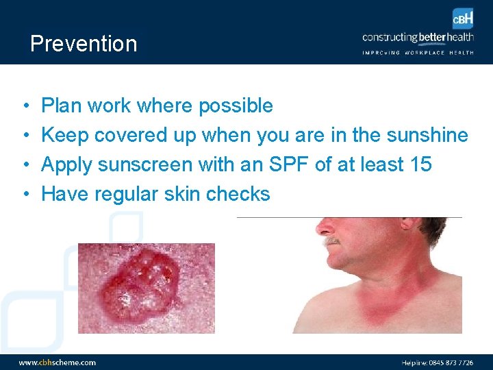 Prevention • • Plan work where possible Keep covered up when you are in