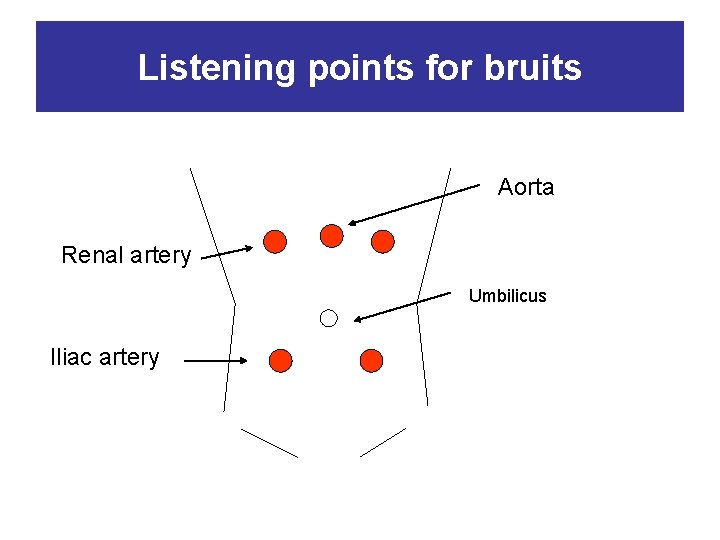 Listening points for bruits Aorta Renal artery Umbilicus Iliac artery 