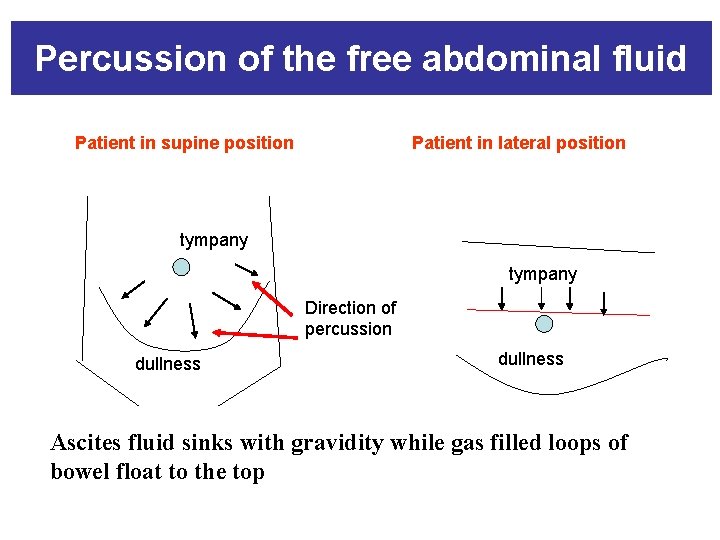 Percussion of the free abdominal fluid Patient in supine position Patient in lateral position