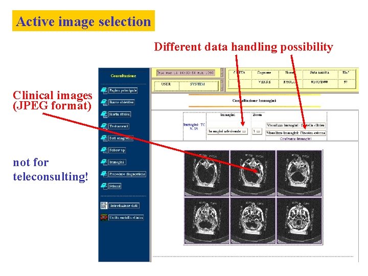 Active image selection Different data handling possibility Clinical images (JPEG format) not for teleconsulting!