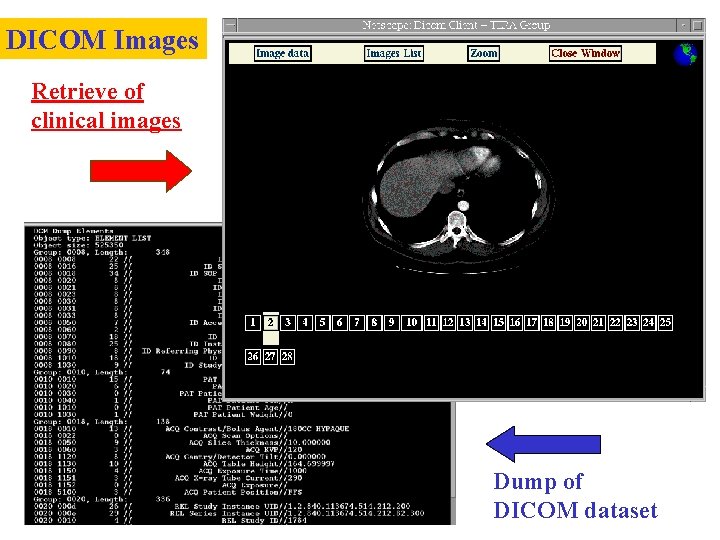 DICOM Images Retrieve of clinical images Dump of DICOM dataset 