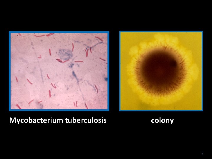 Mycobacterium tuberculosis colony 3 