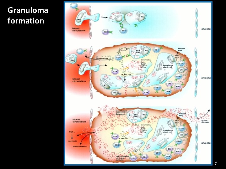 Granuloma formation 7 