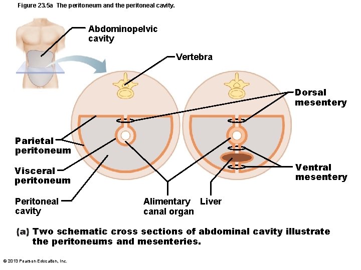 Figure 23. 5 a The peritoneum and the peritoneal cavity. Abdominopelvic cavity Vertebra Dorsal