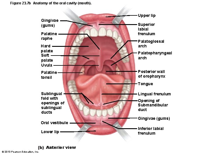 Figure 23. 7 b Anatomy of the oral cavity (mouth). Upper lip Gingivae (gums)