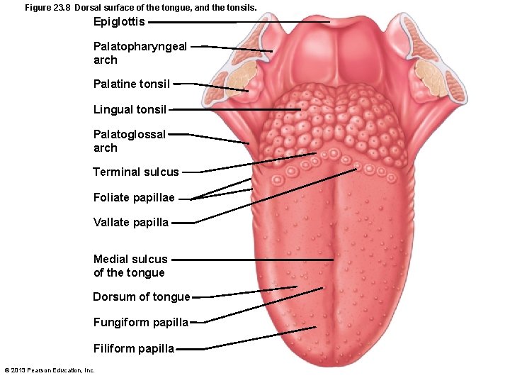 Figure 23. 8 Dorsal surface of the tongue, and the tonsils. Epiglottis Palatopharyngeal arch